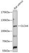 Calcium-activated chloride channel regulator 4 antibody, 18-018, ProSci, Western Blot image 