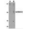 Zinc Finger BED-Type Containing 3 antibody, MBS150552, MyBioSource, Western Blot image 