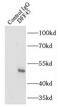 DNA Fragmentation Factor Subunit Alpha antibody, FNab02347, FineTest, Immunoprecipitation image 
