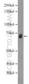 Zinc Finger Protein 284 antibody, 24681-1-AP, Proteintech Group, Western Blot image 