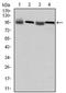 Eukaryotic Translation Elongation Factor 2 antibody, AM06603SU-N, Origene, Western Blot image 