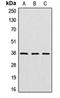 Cathepsin V antibody, orb213809, Biorbyt, Western Blot image 