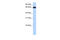 Zinc Finger Protein 14 antibody, 30-731, ProSci, Western Blot image 