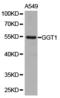 Gamma-Glutamyltransferase 1 antibody, LS-C192783, Lifespan Biosciences, Western Blot image 