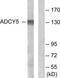 Adenylate cyclase type 5 antibody, TA313424, Origene, Western Blot image 