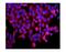ATP Binding Cassette Subfamily B Member 5 antibody, A02979-1, Boster Biological Technology, Immunofluorescence image 