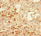 Melanoma-associated antigen 5 antibody, LS-C395979, Lifespan Biosciences, Immunohistochemistry paraffin image 