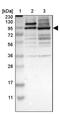 Zinc Finger With KRAB And SCAN Domains 5 antibody, PA5-51857, Invitrogen Antibodies, Western Blot image 