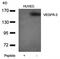 Fms Related Tyrosine Kinase 4 antibody, orb43378, Biorbyt, Western Blot image 