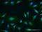 Protein Kinase D1 antibody, H00005587-B01P, Novus Biologicals, Immunocytochemistry image 
