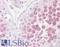 Boule Homolog, RNA Binding Protein antibody, LS-B7334, Lifespan Biosciences, Immunohistochemistry frozen image 