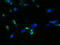 Glucagon-like peptide 1 receptor antibody, A55798-100, Epigentek, Immunofluorescence image 