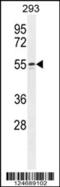 WAS/WASL Interacting Protein Family Member 2 antibody, 55-539, ProSci, Western Blot image 