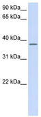 Chromosome 21 Open Reading Frame 91 antibody, TA338937, Origene, Western Blot image 