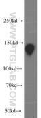 NBR1 Autophagy Cargo Receptor antibody, 16004-1-AP, Proteintech Group, Western Blot image 