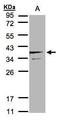 Secretory Carrier Membrane Protein 3 antibody, TA308210, Origene, Western Blot image 