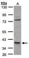 Coiled-Coil Domain Containing 68 antibody, NBP1-31622, Novus Biologicals, Western Blot image 