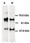 ATP Binding Cassette Subfamily E Member 1 antibody, TA301458, Origene, Western Blot image 