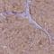 Xenotropic and polytropic retrovirus receptor 1 antibody, HPA016557, Atlas Antibodies, Immunohistochemistry paraffin image 