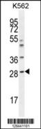 Amyloid P Component, Serum antibody, 55-331, ProSci, Western Blot image 