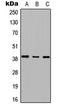 Radial Spoke Head 14 Homolog antibody, LS-C354476, Lifespan Biosciences, Western Blot image 