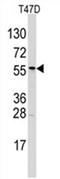 Aldehyde Dehydrogenase 6 Family Member A1 antibody, AP11461PU-N, Origene, Western Blot image 