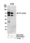 DNA Polymerase Lambda antibody, NB100-81665, Novus Biologicals, Western Blot image 
