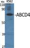 ATP Binding Cassette Subfamily D Member 4 antibody, PA5-50903, Invitrogen Antibodies, Western Blot image 