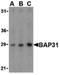 B Cell Receptor Associated Protein 31 antibody, PA5-20199, Invitrogen Antibodies, Western Blot image 