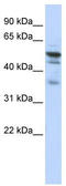 N-Myristoyltransferase 1 antibody, TA339352, Origene, Western Blot image 