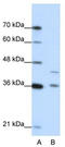 Protein naked cuticle homolog 2 antibody, TA344088, Origene, Western Blot image 