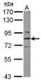 L3MBTL Histone Methyl-Lysine Binding Protein 1 antibody, NBP2-19317, Novus Biologicals, Western Blot image 