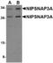 Nipsnap Homolog 3A antibody, LS-B3864, Lifespan Biosciences, Western Blot image 