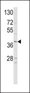 Neurogenic differentiation factor 1 antibody, 60-932, ProSci, Western Blot image 