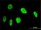 Ankyrin Repeat Domain 17 antibody, H00026057-M02, Novus Biologicals, Immunocytochemistry image 