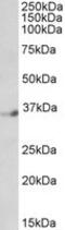 Zinc finger protein neuro-d4 antibody, MBS420823, MyBioSource, Western Blot image 