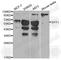 Synaptotagmin 1 antibody, A0992, ABclonal Technology, Western Blot image 