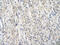 Protein arginine N-methyltransferase 2 antibody, ARP40196_T100, Aviva Systems Biology, Immunohistochemistry paraffin image 