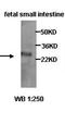 Cell Death Inducing DFFA Like Effector B antibody, orb77115, Biorbyt, Western Blot image 