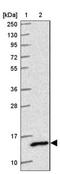 LYR Motif Containing 7 antibody, NBP2-14701, Novus Biologicals, Western Blot image 