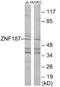 Zinc Finger And SCAN Domain Containing 26 antibody, EKC1838, Boster Biological Technology, Western Blot image 
