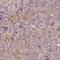 Zinc Finger Protein 790 antibody, HPA056134, Atlas Antibodies, Immunohistochemistry frozen image 