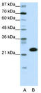 TATA-Box Binding Protein Associated Factor 11 antibody, TA329911, Origene, Western Blot image 