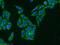 6-phosphogluconate dehydrogenase, decarboxylating antibody, 14718-1-AP, Proteintech Group, Immunofluorescence image 