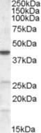 Solute Carrier Family 25 Member 47 antibody, orb19436, Biorbyt, Western Blot image 
