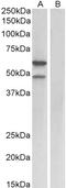 E2F Transcription Factor 3 antibody, TA321026, Origene, Western Blot image 