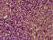 Extracellular Matrix Protein 1 antibody, LS-C670150, Lifespan Biosciences, Immunohistochemistry paraffin image 