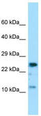 Cytochrome C Oxidase Subunit 7A2 antibody, TA331318, Origene, Western Blot image 
