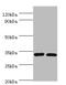 Caspase 7 antibody, A54193-100, Epigentek, Western Blot image 