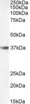 Homeobox A10 antibody, PA5-37866, Invitrogen Antibodies, Western Blot image 
